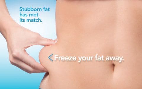 Hips treatment Westminster From Lipo Sculpt