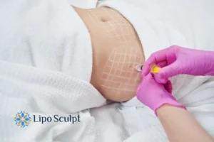 Are The Results From Aqualyx Permanent? 1 Do you want to know how long Aqualyx Westminster results last?